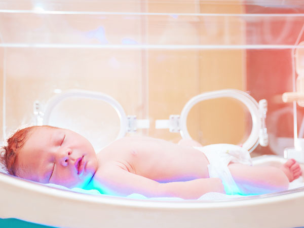 门诊黄疸蓝光治疗