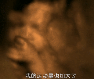 四维彩超